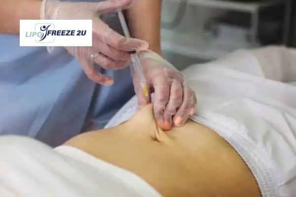 How Does Aqualyx Fat Dissolving Injection Work to Break Down Fat Sheffield?