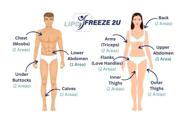 Areas you can have fat freezing treatment Sheffield