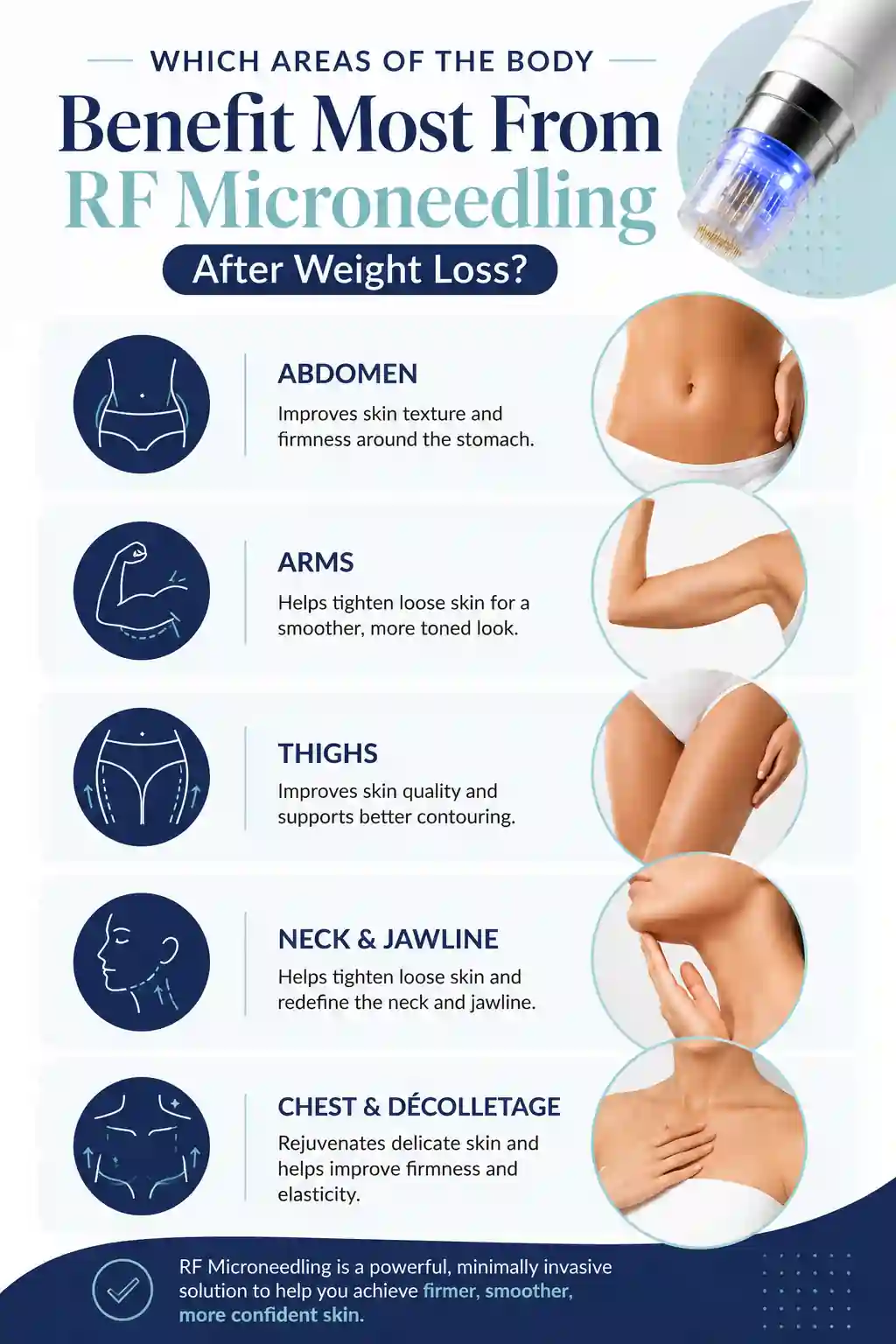 Which Areas of the Body Benefit Most From RF Microneedling After Weight Loss Sheffield